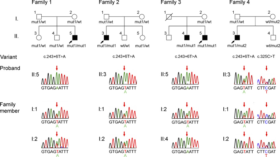 Pedigrees of 4 unrelated families carrying the SGCB c.243+6T>A varian...