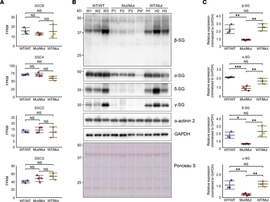 Gene and protein expression of sarcoglycan subunits in cardiac tissue.
(...