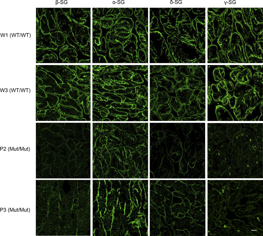 Immunohistochemical analysis of sarcoglycan subunits in cardiac tissue.
...