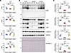 Gene and protein expression of sarcoglycan subunits in cardiac tissue.
