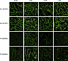Immunohistochemical analysis of sarcoglycan subunits in cardiac tissue.
