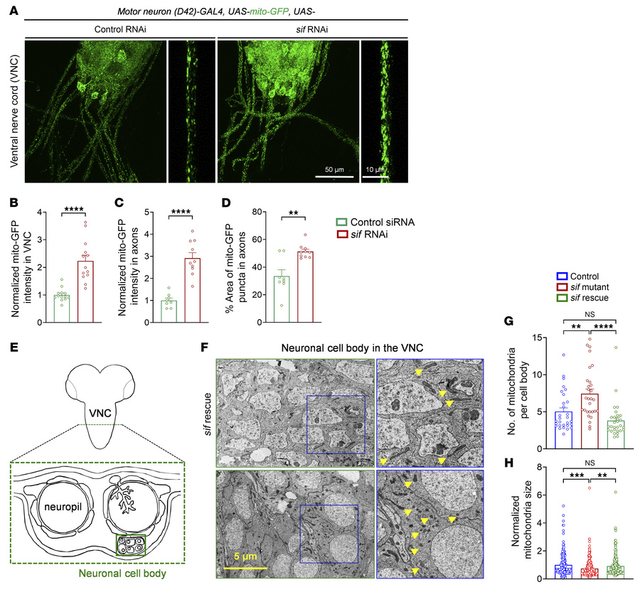 
sif loss leads to an accumulation of mitochondria in glutamatergic neur...