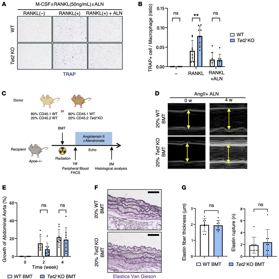 Pharmacological inhibition of TRAP+ macrophage ameliorates AAA phenotype...