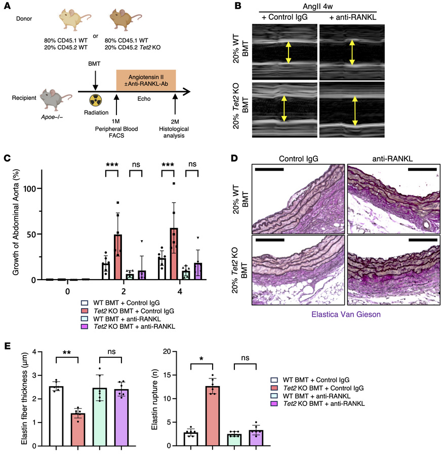 Pharmacological inhibition of TRAP+ macrophages by anti-RANKL antibody a...
