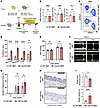 Clonal hematopoietic mouse model shows greater aortic aneurysm formation in