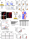BM-derived macrophage involvement in experimental aortic aneurysm.