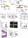 The RANK/RANKL pathway has critical role in TRAP+ macrophage differentiatio