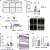 Pharmacological inhibition of TRAP+ macrophage ameliorates AAA phenotype in