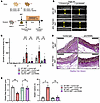 Pharmacological inhibition of TRAP+ macrophages by anti-RANKL antibody amel