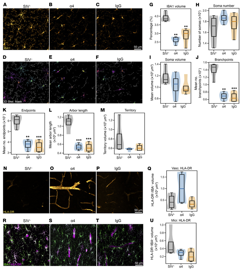 α4 Blockade does not attenuate SIV-induced microglial activation in hipp...