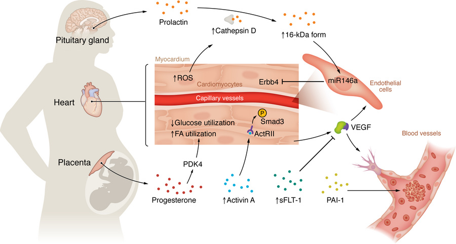 Mechanisms of pregnancy-related cardiovascular complications.
Factors pr...