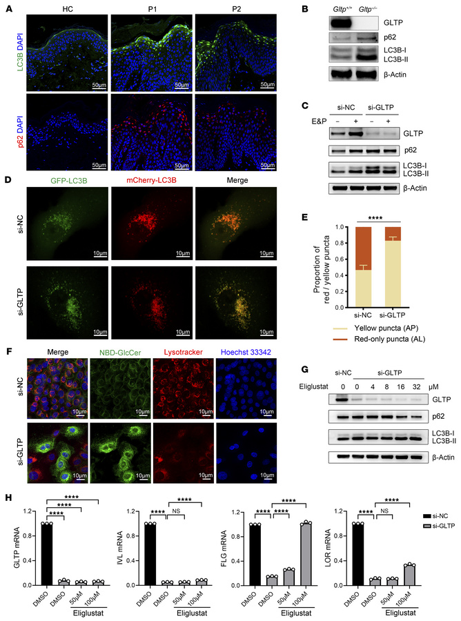 GLTP deficiency impaired autophagy flux via lysosomal GlcCer accumulatio...