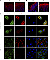 Aberrant glucosylceramide transport in GLTP-deficient differentiated kerati