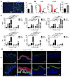 Knockdown of GLTP promoted keratinocyte proliferation and delayed terminal
