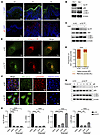 GLTP deficiency impaired autophagy flux via lysosomal GlcCer accumulation i