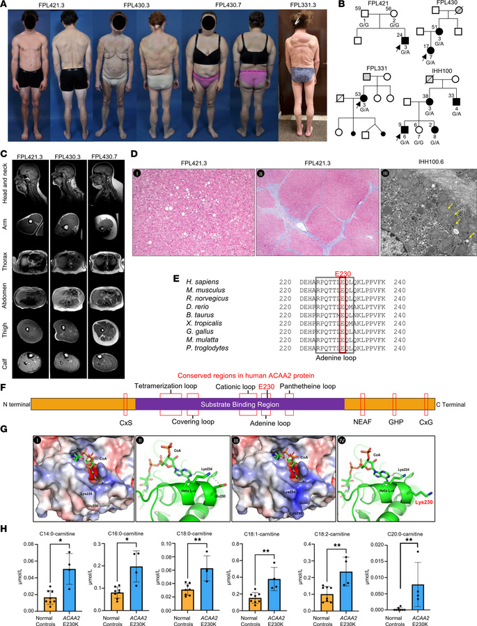 Clinical features, pedigrees, MRI, and liver pathology of patients carry...