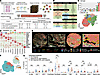 TAMs persist in niraparib nonresponse tumors.