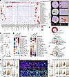 IFNG+ tumor cell–enriched CNs and TAM-CNs are associated with niraparib res