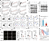 SPP1-mediated immunosuppression correlates with poor prognosis after PARPi