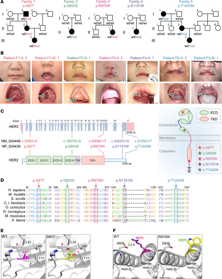 Heterozygous missense HER2 variants cause growth impairment and craniofa...