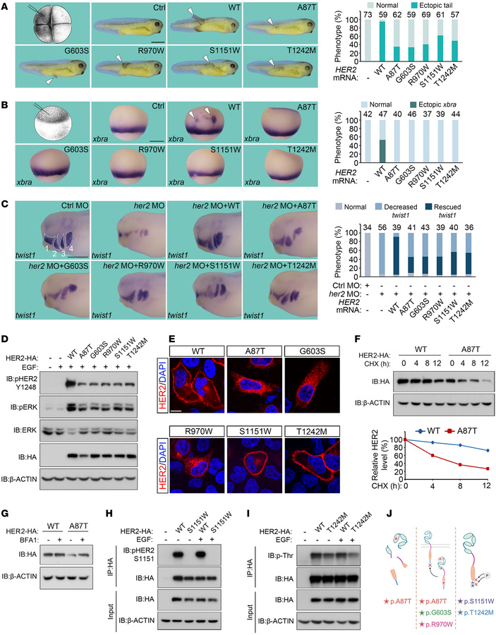 Patient variants impair HER2/ERK signaling.
(A) HER2 variants are less e...
