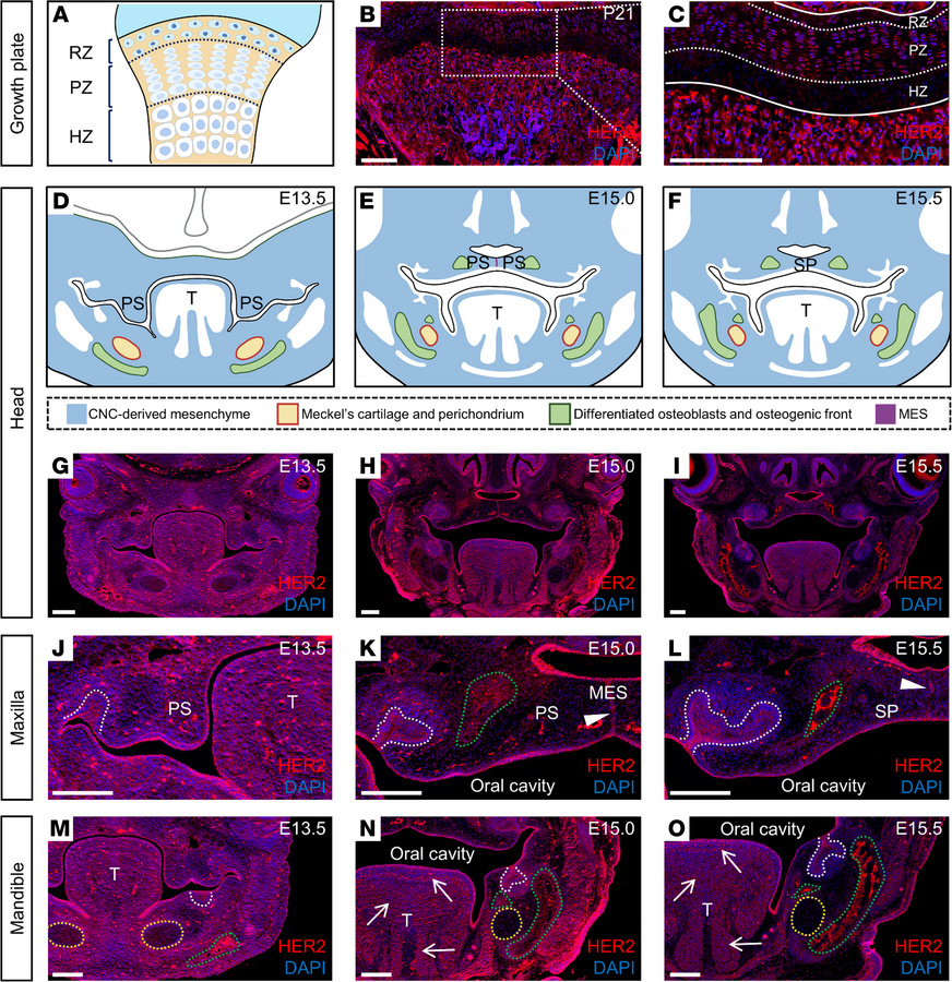 HER2 is expressed in growth plate proliferating chondrocytes and craniof...