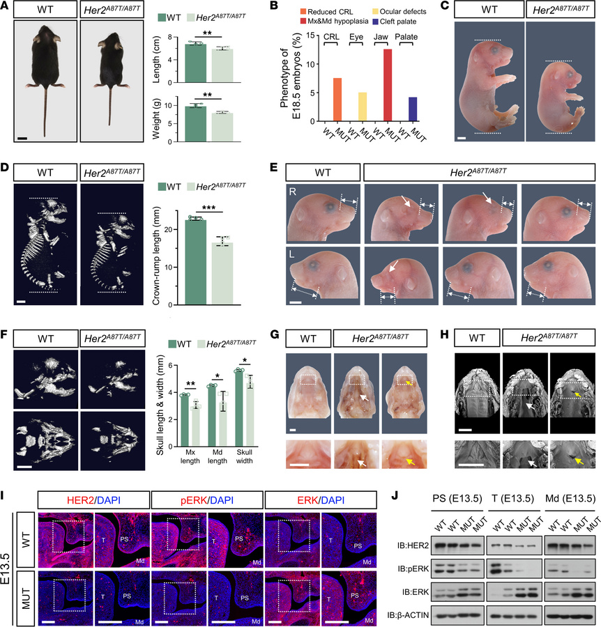 
Her2 p.A87T knock-in mice exhibit growth deficits and craniofacial anom...