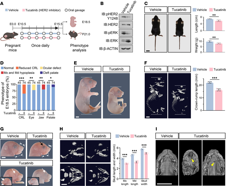 Maternal exposure to Tucatinib results in growth deficits and craniofaci...
