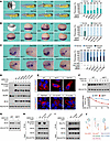 Patient variants impair HER2/ERK signaling.