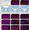 HER2 is expressed in growth plate proliferating chondrocytes and craniofaci