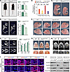Her2 p.A87T knock-in mice exhibit growth deficits and craniofacial anomalie