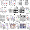 TFPI2 upregulates the CLOCK-BMAL1 complex to promote GSC self renewal and G