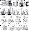 TFPI2 regulates CLOCK-BMAL1 complex through HIF-1α–NF-κB signaling in GSCs.