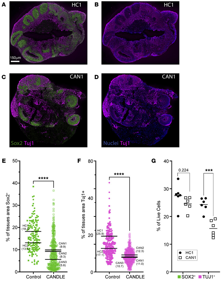 CANDLE COs have altered development.
(A–F) IHC analysis of neural progen...