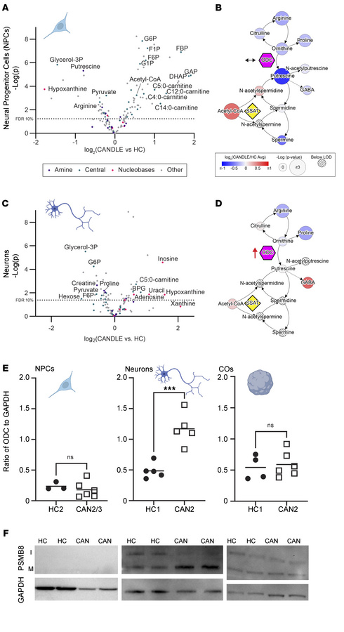 NPCs and Neurons with CANDLE mutation have altered polyamine metabolism....