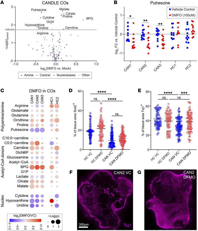 Impact of DFMO on metabolism and neuronal development in CANDLE COs.
(A)...