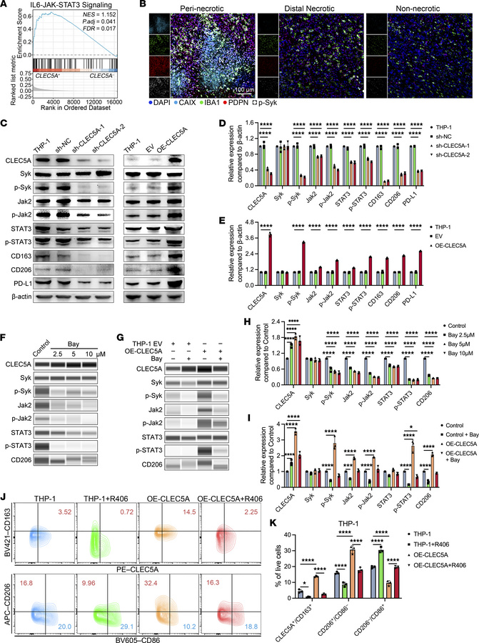 CLEC5A promotes TAM-IM polarization and immunosuppressive TME through Sy...