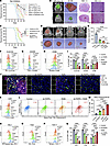 Syk inhibition suppresses tumor progression and reprograms the immunosuppre