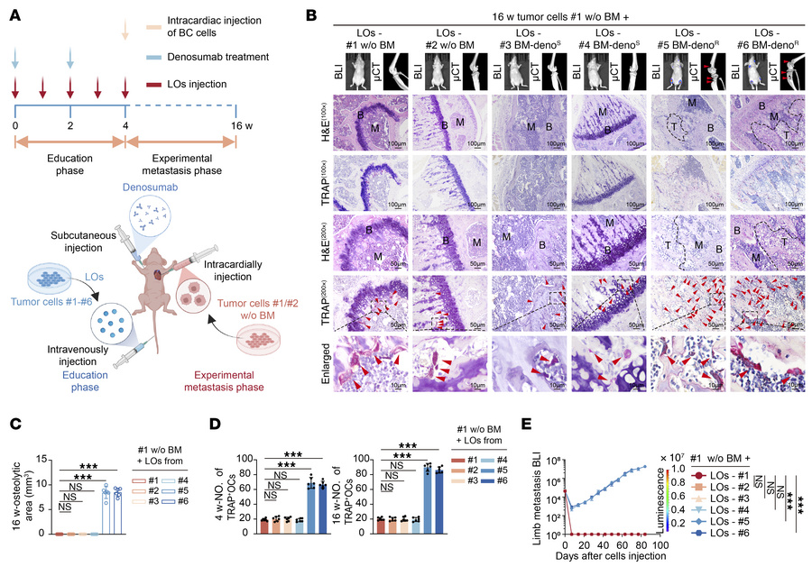 Denosumab-resistant ER+ breast cancer secretes LOs to promote RANKL-inde...