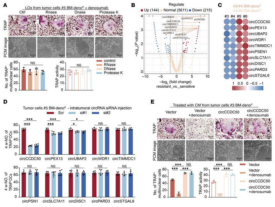 circCCDC50 mediates denosumab-resistant bone metastasis in ER+ breast ca...