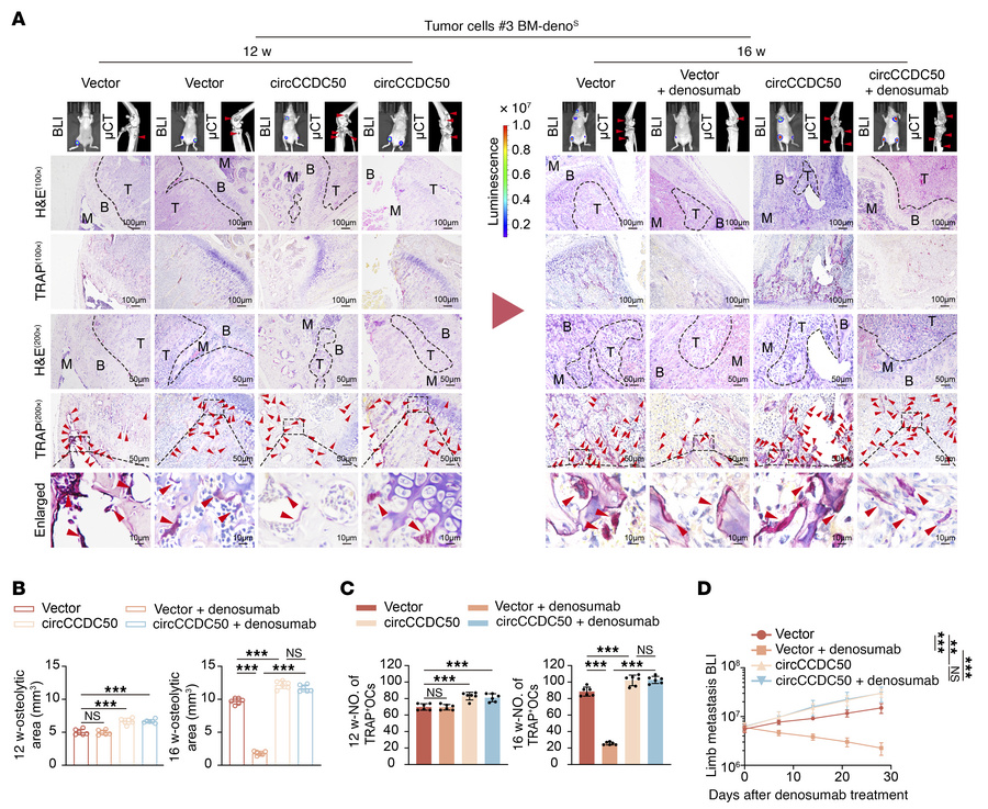 circCCDC50 mediates ER+ breast cancer denosumab resistant bone metastasi...