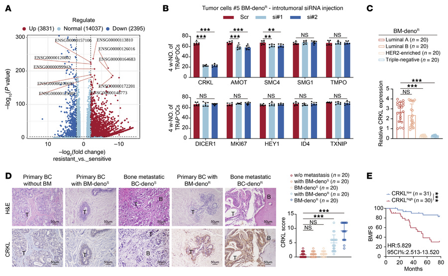 CRKL is upregulated in denosumab-resistant ER+ breast cancer cells and p...