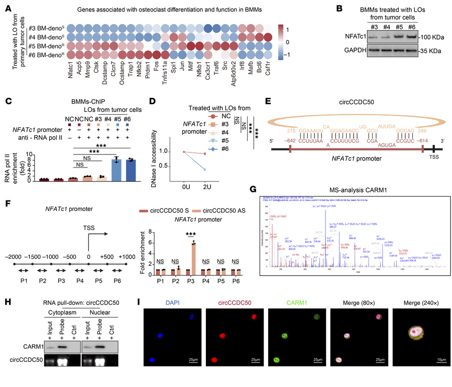 The circCCDC50/CARM1 complex enhances NFATc1 transcription to sustain os...