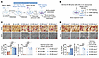 Denosumab-resistant ER+ breast cancer secretes LOs to promote RANKL-indepen