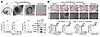 Denosumab-resistant ER+ breast cancer secretes LOs to promote RANKL-indepen