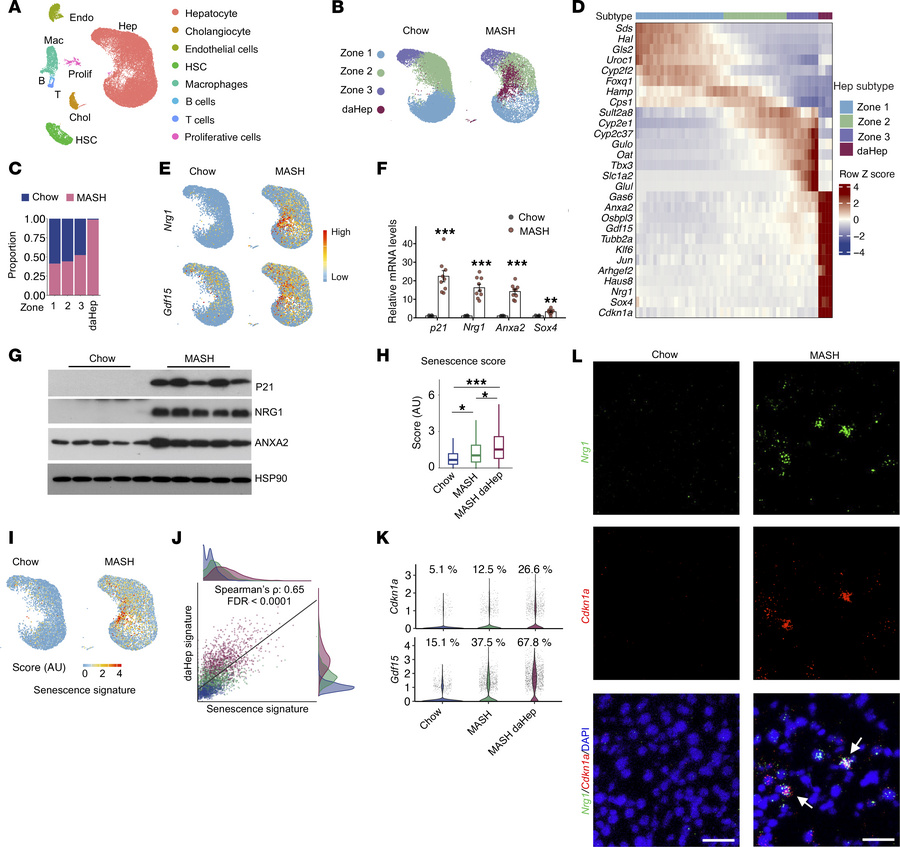 Single-nucleus RNA-seq analysis of healthy and diet-induced MASH livers....
