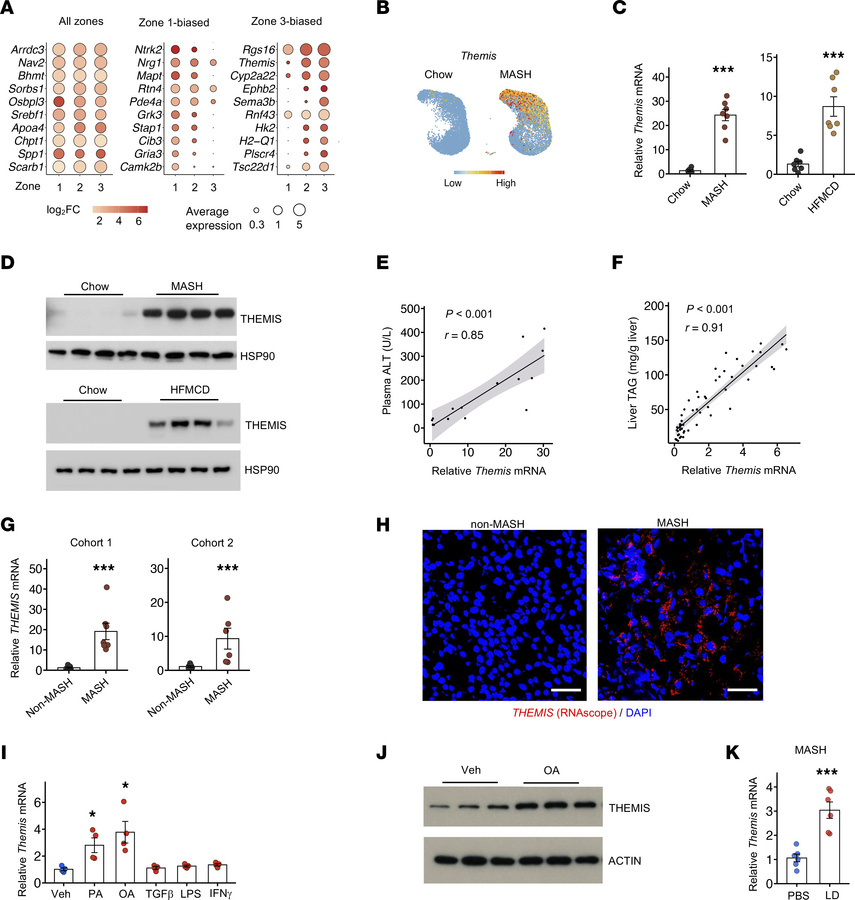 Induction of Themis expression in mouse and human MASH livers.
(A) Class...