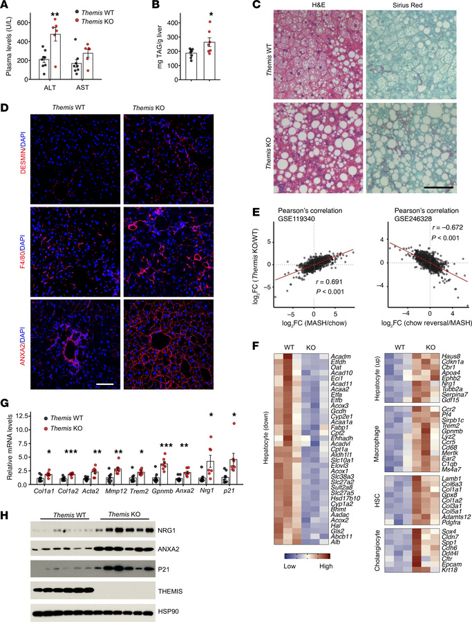 
Themis deficiency accelerates diet-induced MASH progression.
WT (n = 8)...