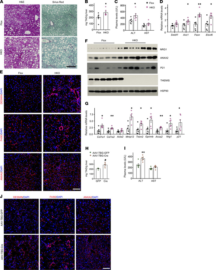 Hepatocyte-specific ablation of THEMIS exacerbates diet-induced MASH.
(A...