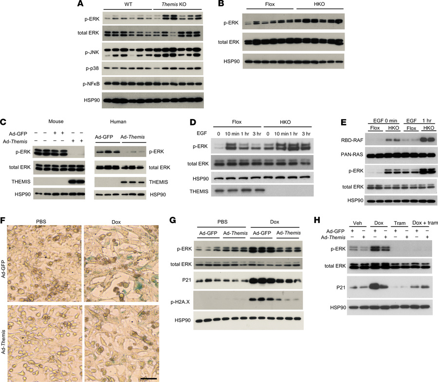 Themis regulates senescence in a cellular autonomous manner via Erk sign...